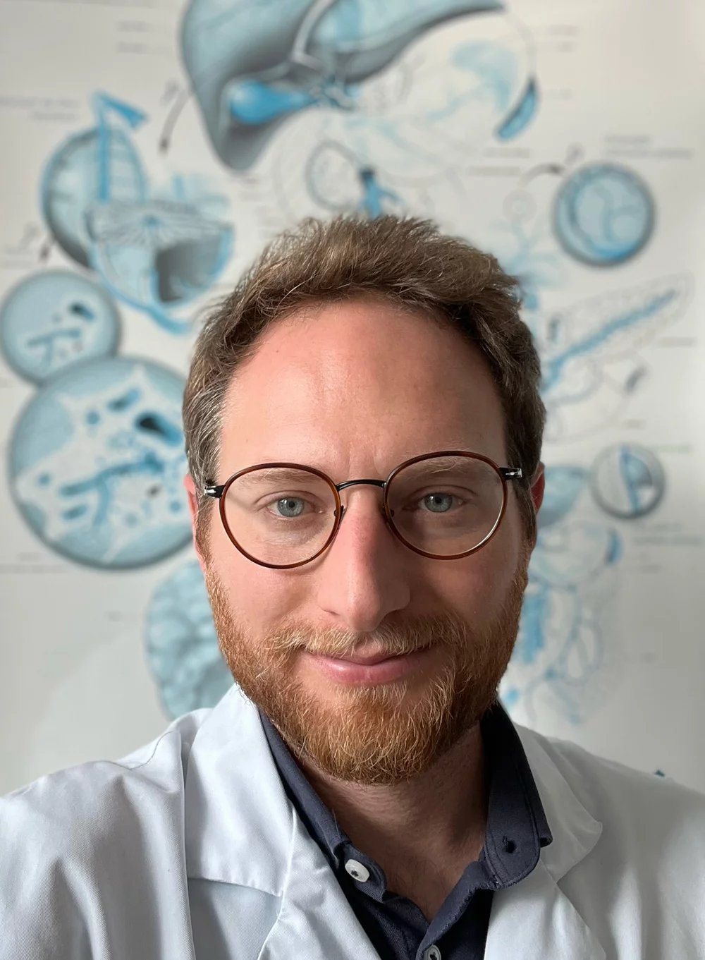 Cirrhose (maladie grave du foie) et muscles : le lien dangereux avec les variations (dysglycémies) du taux de sucre dans le sang (surtout les baisses, les hypoglycémies)